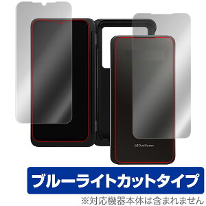 LG G8XThinQ LGfAXN[ Jo[fBXvC ی tB OverLay Eye Protector for LG G8X ThinQ LGfAXN[ Jo[fBXvC یV[gZbg t ی ڂɂ₳ u[