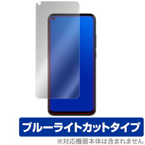 TCL PLEX �ی� �t�B���� OverLay Eye Protector for TCL PLEX �t�� �ی� �ڂɂ₳���� �u���[���C�g �J�b�g �e�B�[�V�[�G�� �X�}�z�t�B���� �������� �~���r�b�N�X
