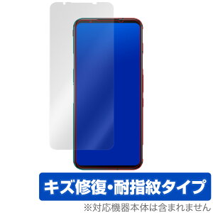 RedMagic5 / RedMagic5G ی tB OverLay Magic for nubia RedMagic 5 / RedMagic 5G tی LYC ώw hw R[eBO X}ztB  ~rbNX