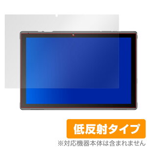 Vankyo S10 ی tB OverLay Plus for Vankyo S10 ^ubg 10.1C` tی A`OA ᔽ  hw oL[S10 ~rbNX