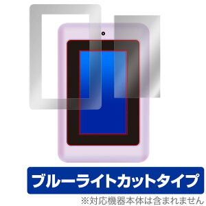 fBYj[sNT[LN^[ }WJX}[gm[g ی tB OverLay Eye Protector for fBYj[sNT[LN^[ }WJX}[gm[g tی ڂɂ₳ u[