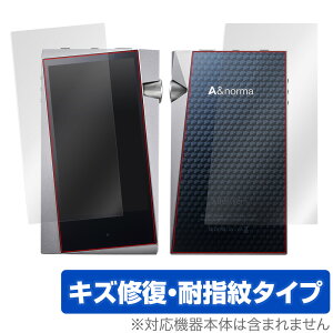 A&norma SR25 MKII / SR25 �\�� �w�� �ی� �t�B���� OverLay Magic �G�[�A���h�m�[�} �\�ʁE�w�ʃZ�b�g �ی� ���C�� �A�X�e���A���h�P����