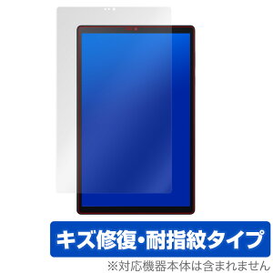LAVIE TabE TE510/KAS / TAB10/F01 ی tB OverLay Magic for LAVIE Tab E TE510/KAS (PC-TE510KAS) / TAB10/F01 (PC-TAB10F01) tی LYC ώw hw R[eBO ~rbNX