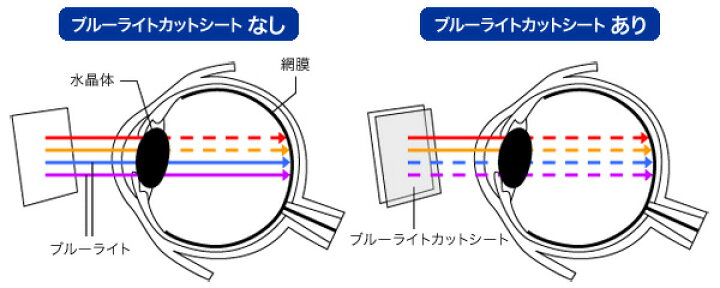 モバイルルーター +F FS040W 保護 フィルム OverLay Eye Protector for モバイルルーター +F  FS040W 液晶保護 目にやさしい ブルーライト カット 富士ソフト ミヤビックス ビザビ 