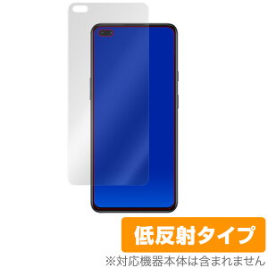 OnePlusNord �ی� �t�B���� OverLay Plus for OnePlus Nord �t���ی� �A���`�O���A �ᔽ�� ����� �h�w�� �����v���X �m�[�h �����v���X �m�[�h �X�}�z�t�B���� �������� �~���r�b�N�X