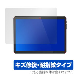 Meize 10�C���` Android 9.0 �^�u���b�gK105 �ی� �t�B���� OverLay Magic for Meize 10�C���` Android 9.0 �^�u���b�g K105 �t���ی� �L�Y�C�� �ώw�� �h�w�� �R�[�e�B���O �X�}�z�t�B���� �������� �~���r�b�N