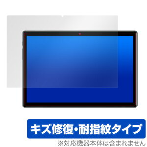 TECLAST P20 HD �ی� �t�B���� OverLay Magic for TECLAST P20HD �t���ی� �L�Y�C�� �ώw�� �h�w�� �R�[�e�B���O �e�b�N���X�g TECLASTP20 HD �~���r�b�N�X