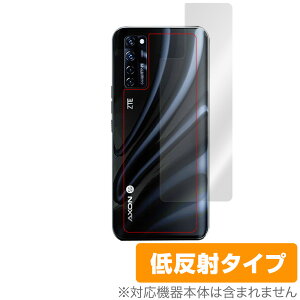 Axon20 �w�� �ی� �t�B���� OverLay Plus for ZTE Axon 20 5G �{�̕ی�t�B���� ���炳���G��ᔽ�ˑf �[�b�g�e�B�[�C�[ �A�N�\�� �A�N�\��20 �~���r�b�N�X
