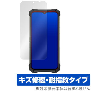 DOOGEE S88 Pro �ی� �t�B���� OverLay Magic for DOOGEE S88 Pro �t���ی� �L�Y�C�� �ώw�� �h�w�� �R�[�e�B���O �h�D�[�W�[S88�v�� �~���r�b�N�X