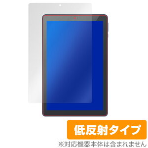 MatrixPadS21 ی tB OverLay Plus for Vankyo MatrixPad S21 ^ubg 10.1C` tی A`OA ᔽ  hw ~rbNX