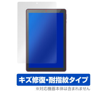 MatrixPadS21 ی tB OverLay Magic for Vankyo MatrixPad S21 ^ubg 10.1C` tی LYC ώw hw R[eBO ~rbNX