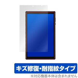 VANKYO P31 �ی� �t�B���� OverLay Magic for VANKYO MatrixPad P31 �t���ی� �L�Y�C�� �ώw�� �h�w�� �R�[�e�B���O �o���L���[ �}�g���b�N�X�p�b�h �~���r�b�N�X