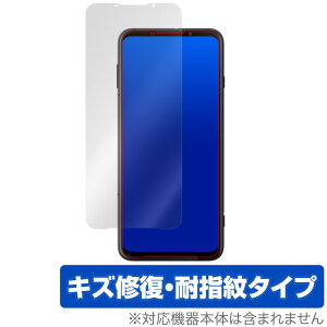 BlackShark3 ی tB OverLay Magic for Black Shark 3 tی LYC ώw hw R[eBO ubNV[N X[ ~rbNX