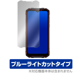 DOOGEES96 Pro �ی� �t�B���� OverLay Eye Protector for DOOGEE S96 Pro �t���ی� �ڂɂ₳���� �u���[���C�g �J�b�g �h�D�[�W�[ S96 �v�� �~���r�b�N�X