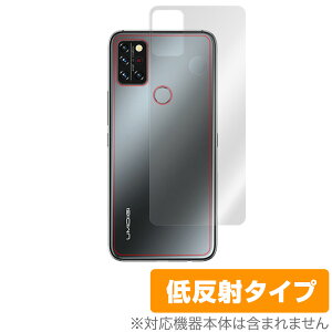 UMIDIGI A9 Pro w ی tB OverLay Plus for UMIDIGI A9 Pro {̕یtB 炳Gᔽˑf ~fBW G[iC v ~rbNX