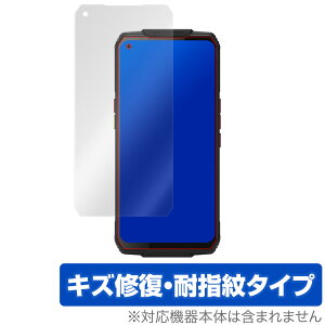 OUKITELWP7 �ی� �t�B���� OverLay Magic for OUKITEL WP7 �t���ی� �L�Y�C�� �ώw�� �h�w�� �R�[�e�B���O �I�E�L�e�� �I�E�L�e��WP7 �~���r�b�N�X