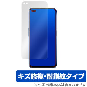 RealmeX50 5G �ی� �t�B���� OverLay Magic for Realme X50 5G �t���ی� �L�Y�C�� �ώw�� �h�w�� �R�[�e�B���O ���A���~�[ ���A���~�[X50 5G �~���r�b�N�X