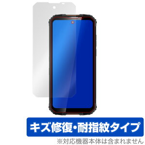 OUKITELWP10 �ی� �t�B���� OverLay Magic for OUKITEL WP10 �t���ی� �L�Y�C�� �ώw�� �h�w�� �R�[�e�B���O �I�E�L�e�� WP10 �~���r�b�N�X