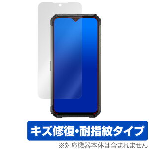Ulefone Armor7 �ی� �t�B���� OverLay Magic for Ulefone Armor 7 �t���ی� �L�Y�C�� �ώw�� �h�w�� �R�[�e�B���O �E���t�H�� �A�[�}�[ �Z�u�� �~���r�b�N�X