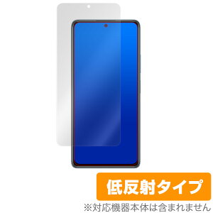 Redmi Note 10 Pro ی tB OverLay Plus for Xiaomi Redmi Note 10 Pro tی A`OA ᔽ  hw VI~[ h~m[g10 v ~rbNX