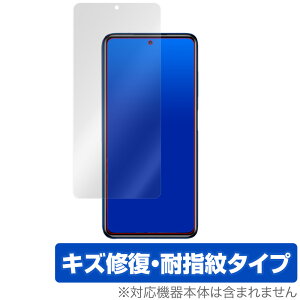 POCO X3 Pro �ی� �t�B���� OverLay Magic for Xiaomi POCO X3 Pro �t���ی� �L�Y�C�� �ώw�� �h�w�� �R�[�e�B���O POCOX3 �V���I�~�[ �|�RX3 �v�� �~���r�b�N�X