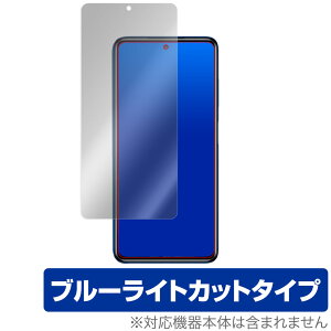 POCO X3 Pro �ی� �t�B���� OverLay Eye Protector for Xiaomi POCO X3 Pro �t���ی� �ڂɂ₳���� �u���[���C�g �J�b�g POCOX3 �V���I�~�[ �|�RX3 �v�� �~���r�b�N�X