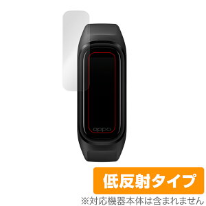 OPPO Band Style �ی� �t�B���� OverLay Plus for OPPO Band Style �t���ی� �A���`�O���A �ᔽ�� ����� �h�w�� �I�b�| �o���h�X�^�C�� �X�}�[�g�E�H�b�` �~���r�b�N�X