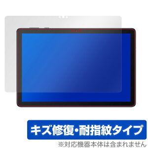 HUAWEI MatePad T 10s 10.1 �ی� �t�B���� OverLay Magic for HUAWEI MatePad T 10s 10.1�C���` �t���ی� �L�Y�C�� �ώw�� �h�w�� �R�[�e�B���O �~���r�b�N�X