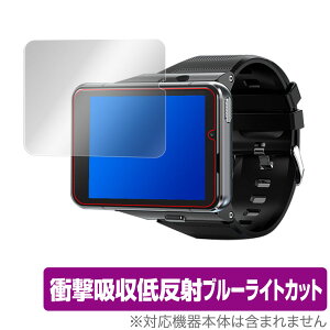 S999 4G SmartWatch �ی� �t�B���� OverLay Absorber for S999 4G Smart Watch �Ռ��z�� �ᔽ�� �u���[���C�g�J�b�g �A�u�\�[�o�[ �R�� �X�}�[�g�E�H�b�` �~���r�b�N�X