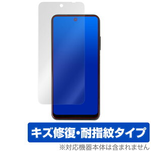 Poco M3 Pro ی tB OverLay Magic for Xiaomi Poco M3 Pro 5G tی LYC ώw hw R[eBO VI~[ |R M3 v PocoM3 Pro ~rbNX