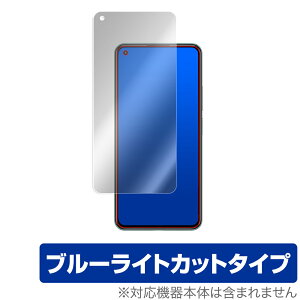 Xiaomi Mi11 Lite ی tB OverLay Eye Protector for Xiaomi Mi 11 Lite 5G tی u[CgJbg VI~[ ~[ Cu Cg ~rbNX