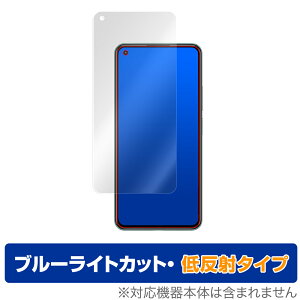 Xiaomi Mi11 Lite ی tB OverLay Eye Protector ᔽ for Xiaomi Mi 11 Lite 5G tی u[CgJbg VI~[ ~[ Cu Cg ~rbNX