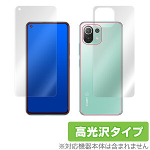 Xiaomi Mi 11 Lite 5G \ w tB OverLay Brilliant for VI~[ Mi11 Cg w䂪ɂ hw  VI~[~[CuCg ~rbNX