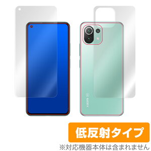 Xiaomi Mi 11 Lite 5G \ w tB OverLay Plus for VI~[ Mi11 Cg A`OA ᔽ  hw VI~[~[CuCg ~rbNX