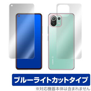 Xiaomi Mi 11 Lite 5G \ w tB OverLay Eye Protector for VI~[ Mi11 Cg ڂɂ₳ u[Cg Jbg VI~[~[CuCg ~rbNX