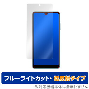 Xperia AceII SO41B ی tB OverLay Eye Protector ᔽ for Xperia Ace II SO-41B tی u[CgJbg f荞ݒጸ GNXyA G[X2 ~rbNX