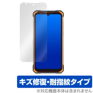 DOOGEES86 �ی� �t�B���� OverLay Magic for DOOGEE S86 �t���ی� �L�Y�C�� �ώw�� �h�w�� �R�[�e�B���O �~���r�b�N�X