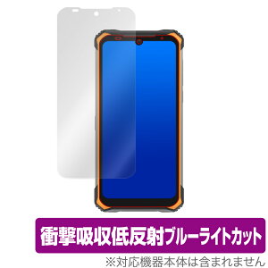 DOOGEES86 �ی� �t�B���� OverLay Absorber for DOOGEE S86 �Ռ��z�� �ᔽ�� �u���[���C�g�J�b�g �A�u�\�[�o�[ �R�� �~���r�b�N�X