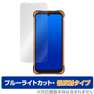 DOOGEES86 �ی� �t�B���� OverLay Eye Protector �ᔽ�� for DOOGEE S86 �t���ی� �u���[���C�g�J�b�g �f�荞�݂�}���� �~���r�b�N�X