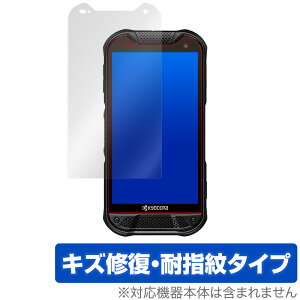 DuraForce PRO 2 �ی� �t�B���� OverLay Magic for DuraForce PRO2 �t���ی� �L�Y�C�� �ώw�� �h�w�� �R�[�e�B���O �f�����t�H�[�X �v���c�[ �~���r�b�N�X
