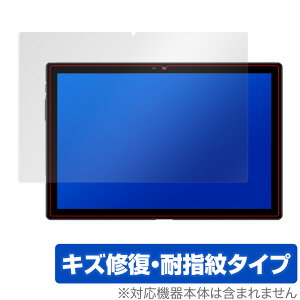 Blackview Tab 9 �ی� �t�B���� OverLay Magic for BlackviewTab 9 �t���ی� �L�Y�C�� �ώw�� �h�w�� �R�[�e�B���O �u���b�N�r���[ �^�u9 �~���r�b�N�X