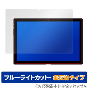 Blackview Tab 9 �ی� �t�B���� OverLay Eye Protector �ᔽ�� for BlackviewTab 9 �t���ی� �u���[���C�g�J�b�g �f�荞�݂�}���� �u���b�N�r���[ �^�u9 �~���r�b�N�X