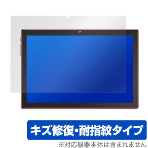 VANKYO P40 �ی� �t�B���� OverLay Magic for VANKYOP40 �t���ی� �L�Y�C�� �ώw�� �h�w�� �R�[�e�B���O �~���r�b�N�X