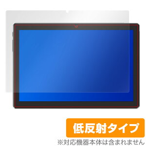 MARVUE Pad M30 ^ubg ی tB OverLay Plus for MARVUEPad ^ubg M30 tی A`OA ᔽ  hw ~rbNX