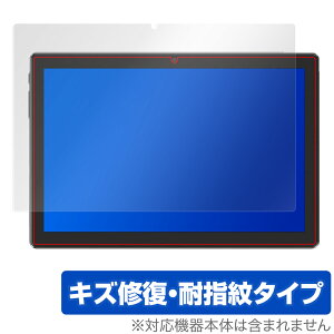 MARVUE Pad M30 ^ubg ی tB OverLay Magic for MARVUEPad ^ubg M30 tی LYC ώw hw R[eBO ~rbNX