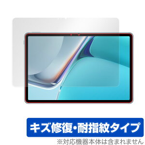 HUAWEI MatePad 11 ی tB OverLay Magic for t@[EFC ^ubg Cgpbh11 tی LYC ώw hw R[eBO MatePad11 ~rbNX