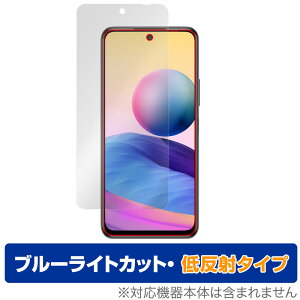 Redmi Note 10 JE XIG02 ی tB OverLay Eye Protector ᔽ for au Xiaomi VI~[ h~ m[g10 Note10 tی u[CgJbg ˒ጸ ~rbNX