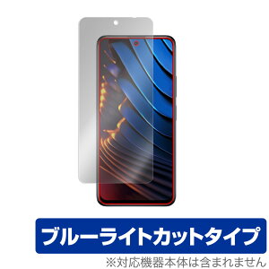 Xiaomi POCO X3 GT �ی� �t�B���� OverLay Eye Protector for �V���I�~�[ �X�}�[�g�t�H�� �|�R X3 GT �t���ی� �ڂɂ₳���� �u���[���C�g �J�b�g �~���r�b�N�X