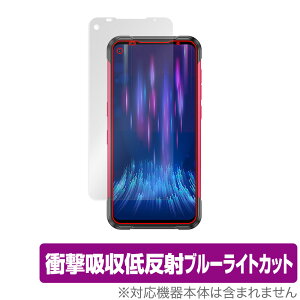 DOOGEE S97 Pro �ی� �t�B���� OverLay Absorber for �h�D�[�W�[ �X�}�[�g�t�H�� S97 �v�� �Ռ��z�� �ᔽ�� �u���[���C�g�J�b�g �A�u�\�[�o�[ �R�� �~���r�b�N�X