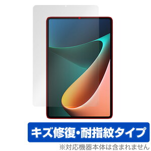 Xiaomi Pad 5 Pro / Xiaomi Pad 5 �ی� �t�B���� OverLay Magic for �V���I�~�[ �p�b�h 5 �v�� 5G Wi-Fi �t���ی� �L�Y�C�� �ώw�� �h�w�� �R�[�e�B���O �~���r�b�N�X